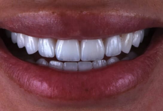 trust academy dental courses 1 1