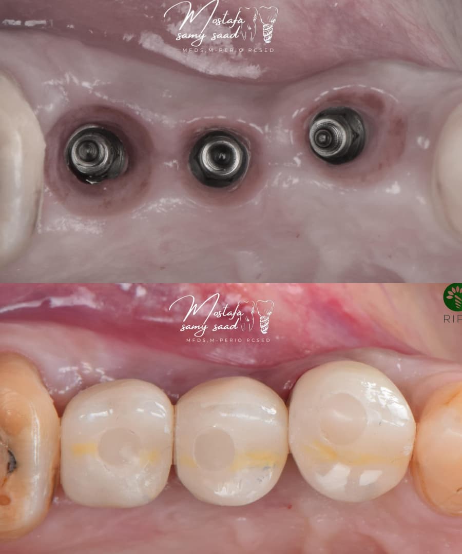 trust-academy-dental-courses (22)