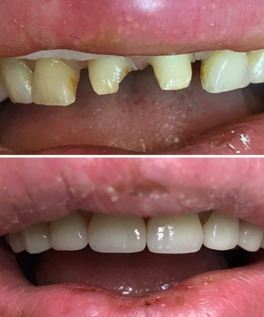 trust-academy-dental-courses (27)