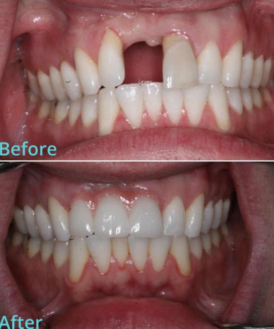 trust-academy-dental-courses (33)