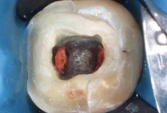 trust academy dental courses 4 3